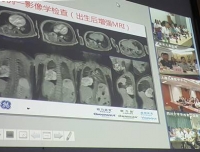 依托远程网络，开展全国儿科影像疑难病例讨论