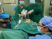 妇科李征宇教授团队开展“常规器械单孔腹腔镜手术”新术式