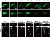 Jia Da’s group identified the link between defects in cellular trafficking and Pontocerebellar hypoplasia