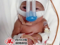 【四川日报】哇！#巴掌大四川最小胎龄超早产儿出院#！出生时仅22周6天