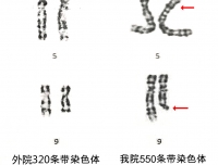 产前诊断中心高分辨率染色体核型分析（550条带）助力发现复发性流产患者病因