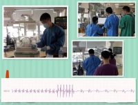 儿童心血管科CICU成功实施紧急食道调搏术终止新生儿难治性心动过速
