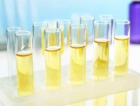 尿液检查标本收集知多少？