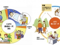 自动腹膜透析治疗模式