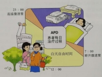 自动腹膜透析治疗处方设定和调整