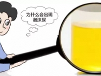 泡沫尿就是得了肾脏病？